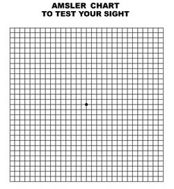 Speedoc - Take a minute to test your eyesight! The Amsler eye test